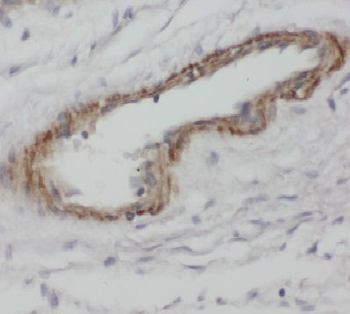 FBXO28 Rabbit Polyclonal Antibody