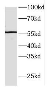 FBXO5 Antibody