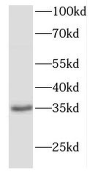 FBXO6 Antibody