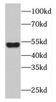 FBXO9 Antibody