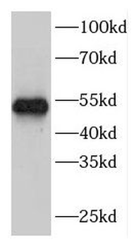 FBXW2 Antibody