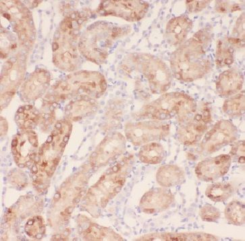 FBXW5 Rabbit Polyclonal Antibody