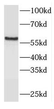 FCRLB Rabbit Polyclonal Antibody