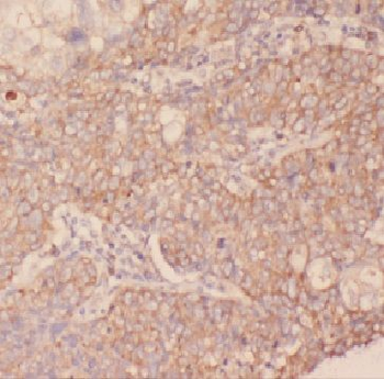 FCRLB Rabbit Polyclonal Antibody