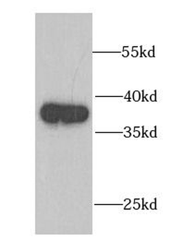 FDPS Antibody