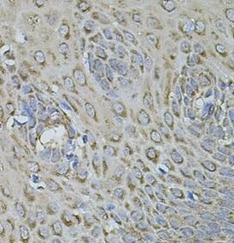 FDX1 Rabbit Polyclonal Antibody