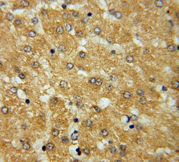 FDXR Rabbit Polyclonal Antibody