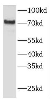 FEM1A Rabbit Polyclonal Antibody