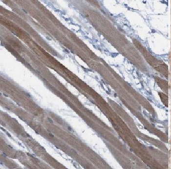 FEM1A Rabbit Polyclonal Antibody