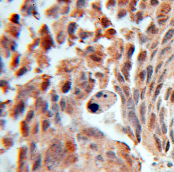 FEM1B Rabbit Polyclonal Antibody