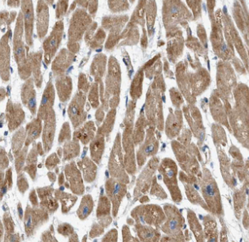 FEM1C Rabbit Polyclonal Antibody