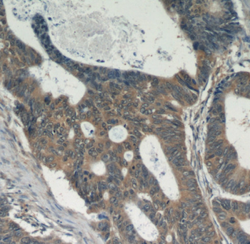 FER Rabbit Polyclonal Antibody