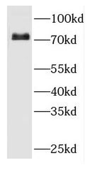 FERMT1 Rabbit Polyclonal Antibody