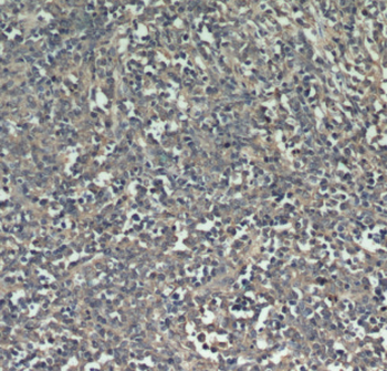 FERMT3 Rabbit Polyclonal Antibody
