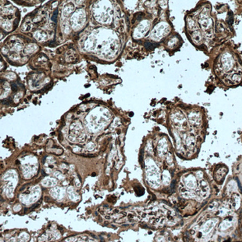 FGD3 Rabbit Polyclonal Antibody