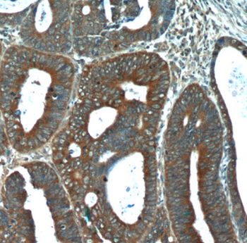 FGFBP1 Antibody