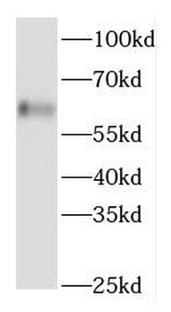 FGFBP3 Rabbit Polyclonal Antibody