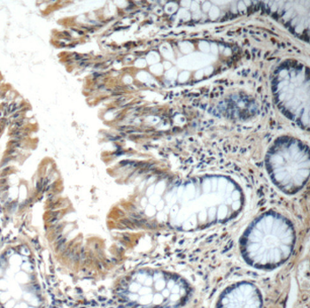 FGFBP3 Rabbit Polyclonal Antibody