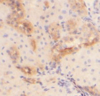 FGL1 Rabbit Polyclonal Antibody