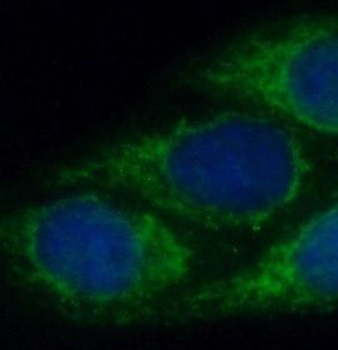 FGL2 Antibody