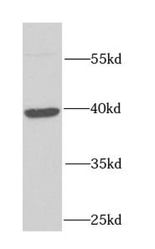 FHL1 Rabbit Polyclonal Antibody