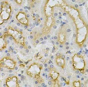 FHL1 Rabbit Polyclonal Antibody