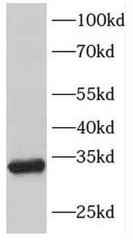 FHL3 Rabbit Polyclonal Antibody