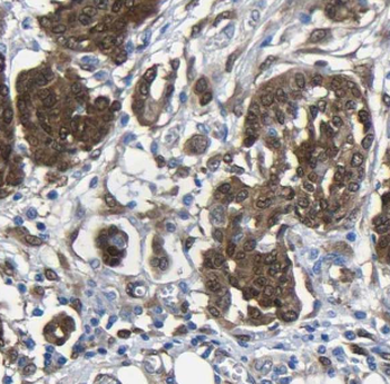 FHL3 Rabbit Polyclonal Antibody