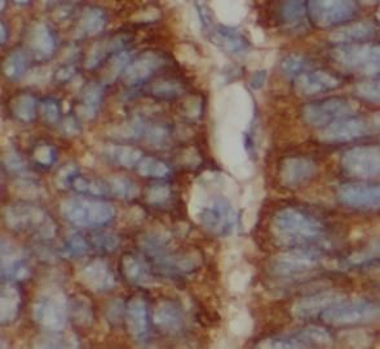 FGG Rabbit Polyclonal Antibody