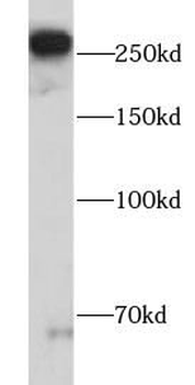 FN1 Antibody
