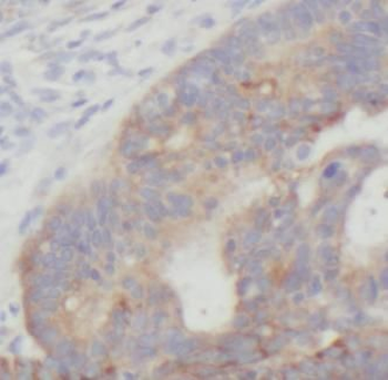 FN1 Rabbit Polyclonal Antibody
