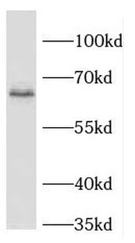 FKBP10 Rabbit Polyclonal Antibody