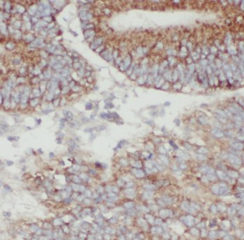 FKBP10 Rabbit Polyclonal Antibody