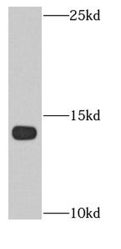 FKBP2 Rabbit Polyclonal Antibody