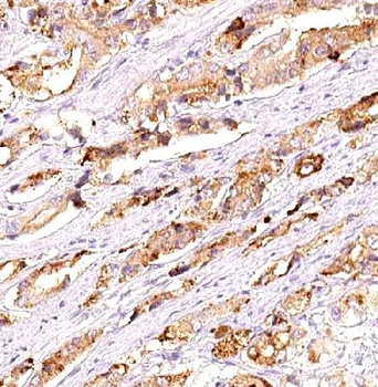 FKBP2 Rabbit Polyclonal Antibody