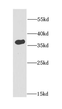 FKBP6 Rabbit Polyclonal Antibody