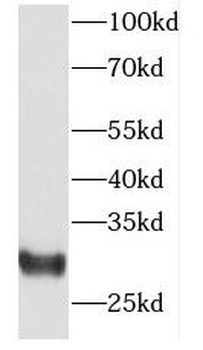 FKBP7 Antibody