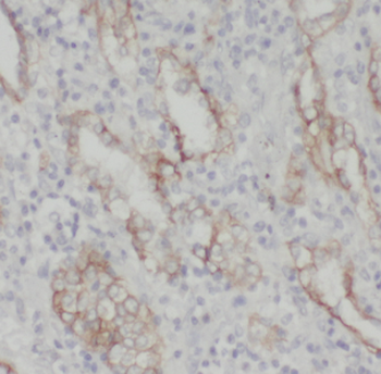 FKBP7 Rabbit Polyclonal Antibody