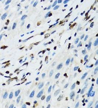 FLI1 Rabbit Polyclonal Antibody