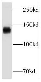 FLT3 Rabbit Polyclonal Antibody