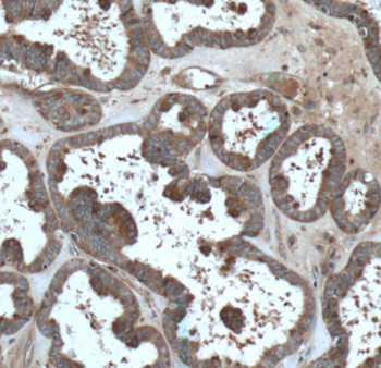 FMN2 Antibody