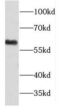 FMO5 Rabbit Polyclonal Antibody