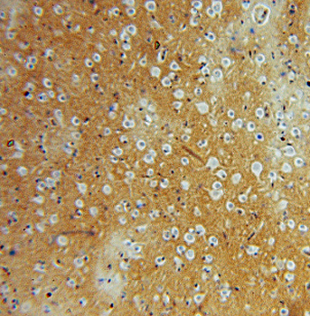 FN3KRP Rabbit Polyclonal Antibody