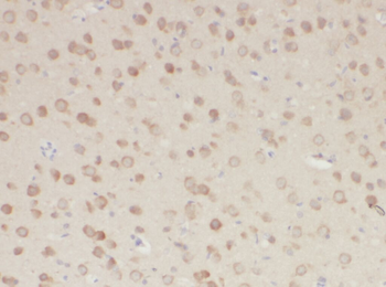 FOXO1 Rabbit Polyclonal Antibody