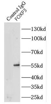 FOXP3 Rabbit Polyclonal Antibody