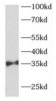 FOXR1 Antibody