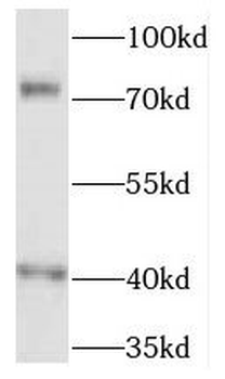 FREM1 Antibody