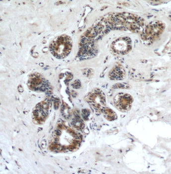 FRK Rabbit Polyclonal Antibody