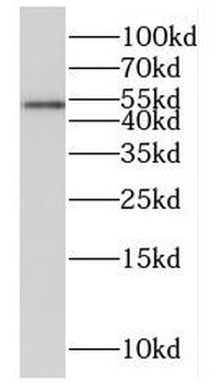 FTCD Rabbit Polyclonal Antibody