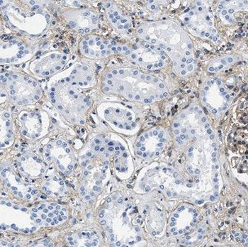 FTCD Rabbit Polyclonal Antibody